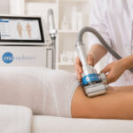 ICONIQUE-Erfahrungen-mit-der-Endosphères-Therapie